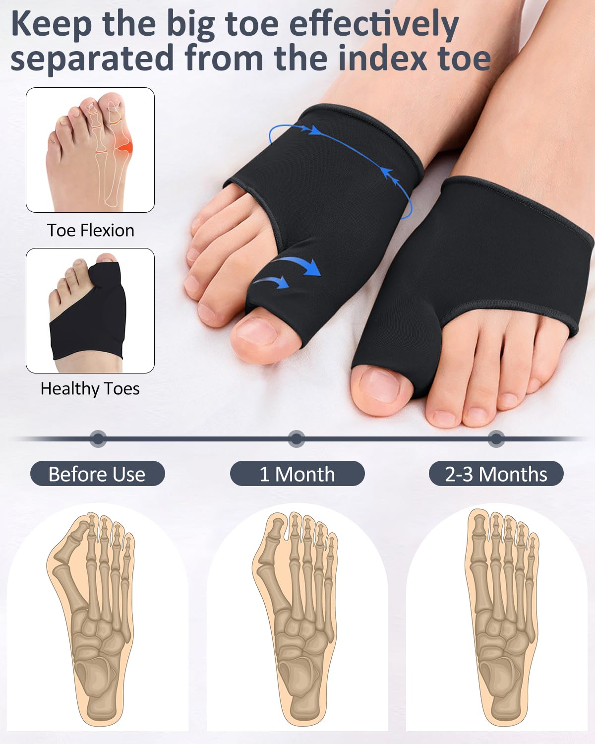 PGRODE 2 Pcs Bunion Corrector for Women Men Bunion Pain Relief Big Toe Straighteners - Image 3