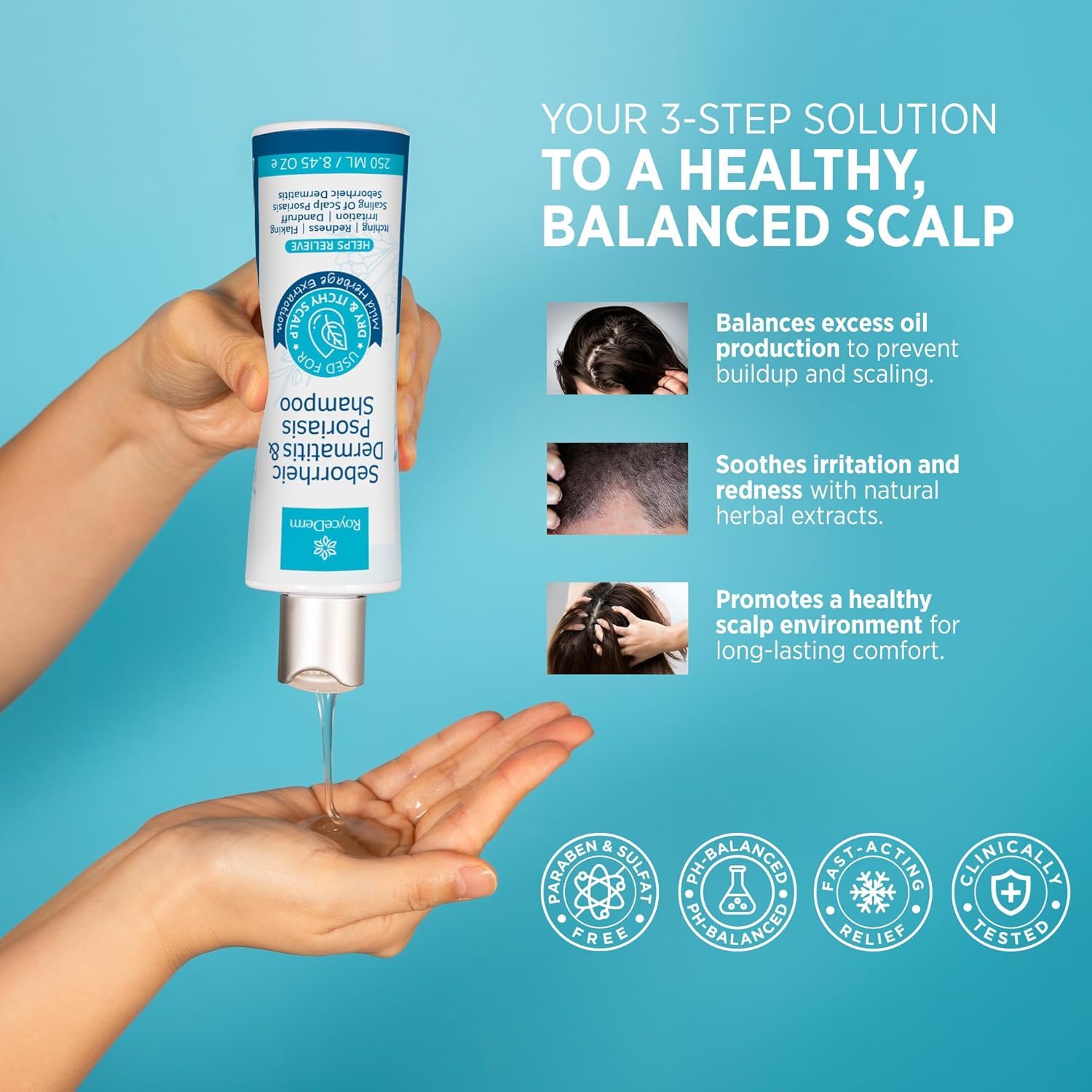 Roycederm Seborrheic Dermatitis & Psoriasis Scalp Treatment Kit – Shampoo + Cream for Dry Itchy Scalp, Dandruff, Folliculitis Relief, Anti-Itch & Soothing Care System