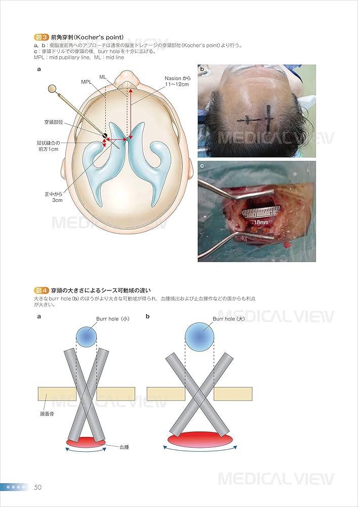 脳室を征服する (新NS NOW 13) : Amazon.sg: Books