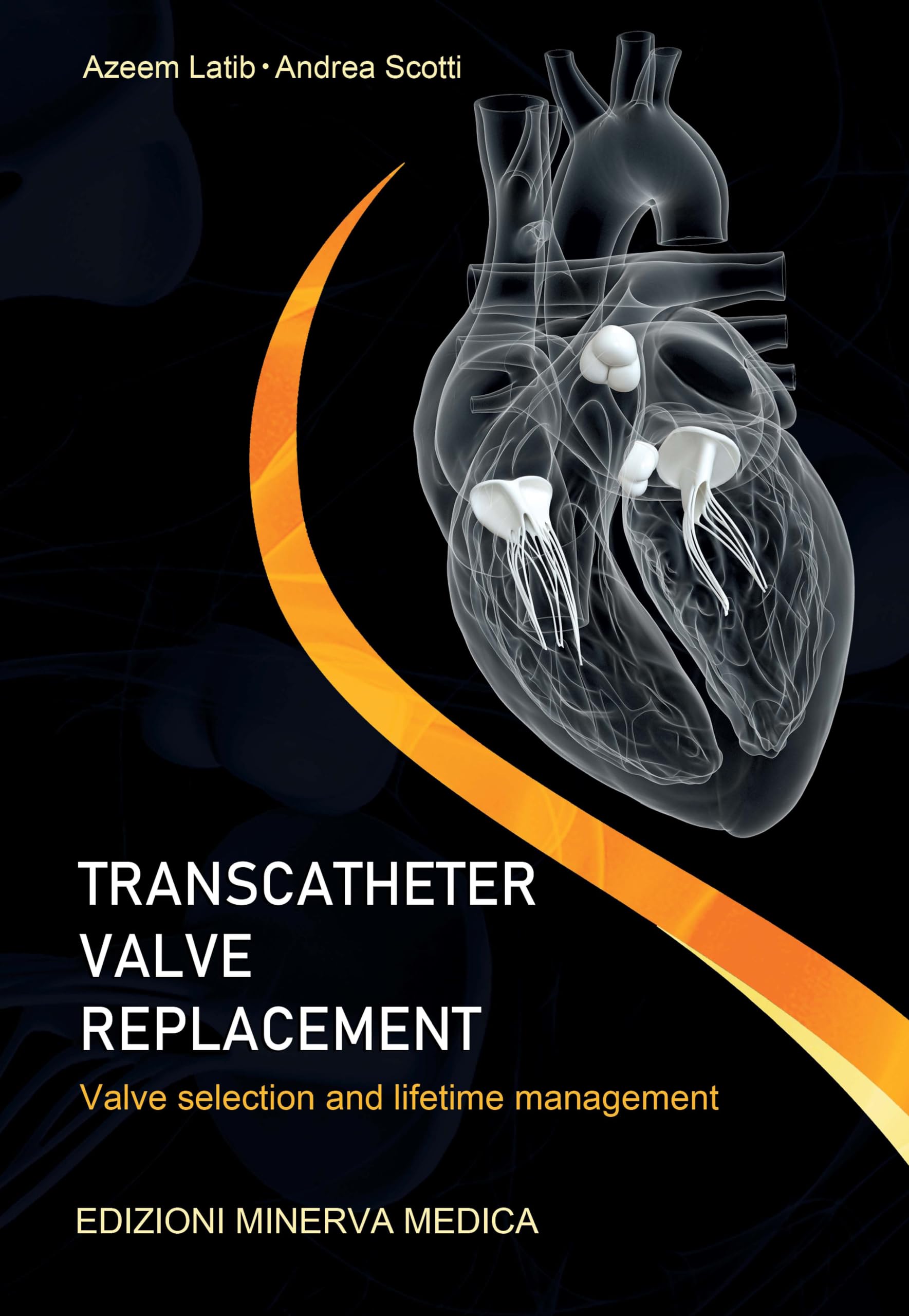 Transcatheter valve replacement. Valve selection and lifetime management