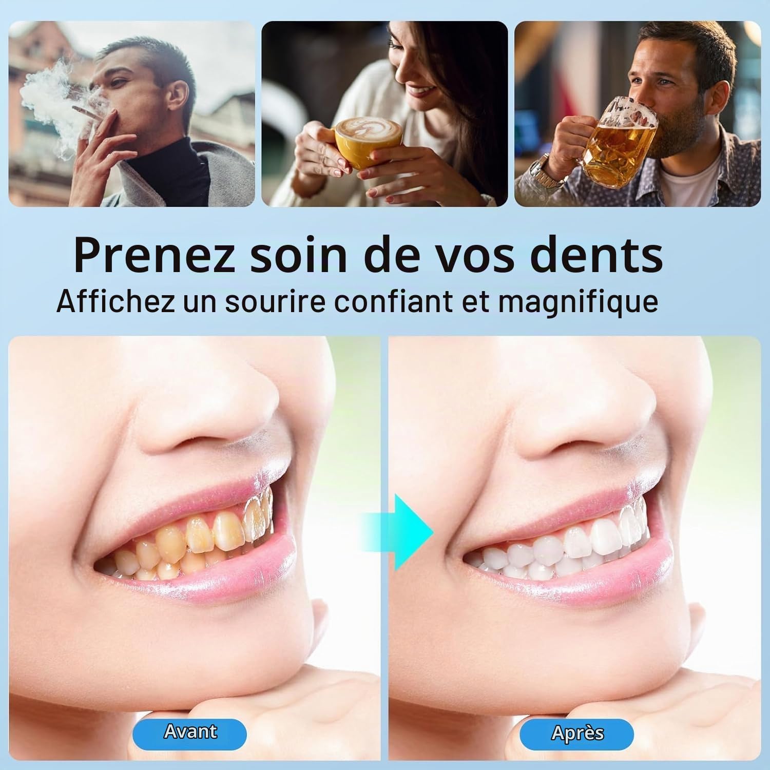 Polisseur Dentaire & Kit Blanchiment Dentaire pour le Polissage des Dents | Blanchiment Dentaire Professionnel avec 5 Mode Polissage et 3 Types de Pate a Polir, Blanchiment des Dents