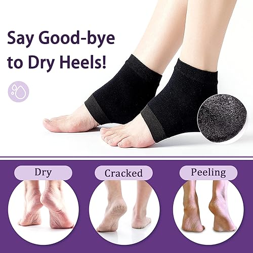 Miniatura 2 de Calcetines de gel hidratantes para reparar talones agrietados, calcetines de silicona con punta abierta para piel seca para spa, cuidado nocturno de