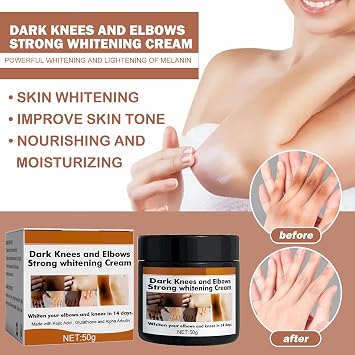 2025 new 1/2pcs Crema Para Manchas Oscuras En La Cara Pink Privates Intimate Area cream crema Para Las Manchas De La Cara,Para Piel Entrepierna,Manchas Codos,Piernas Zonas,Rodillas Cuello (3pcs)