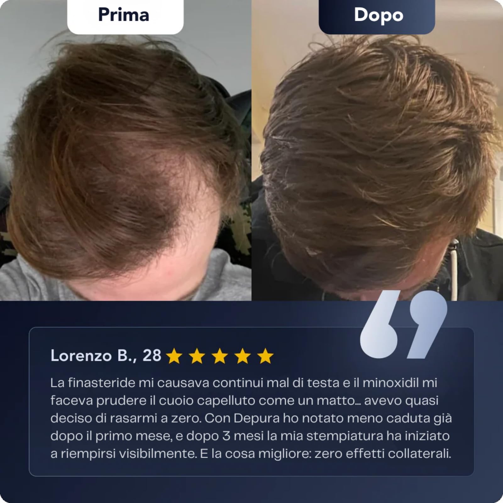 Depura - Siero Rigenerante per Capelli，Siero per Capelli Roll On al Rosmarino, Anti-Caduta e Crescita Capillare, Nutre Cuoio Capelluto e Rafforza Radici