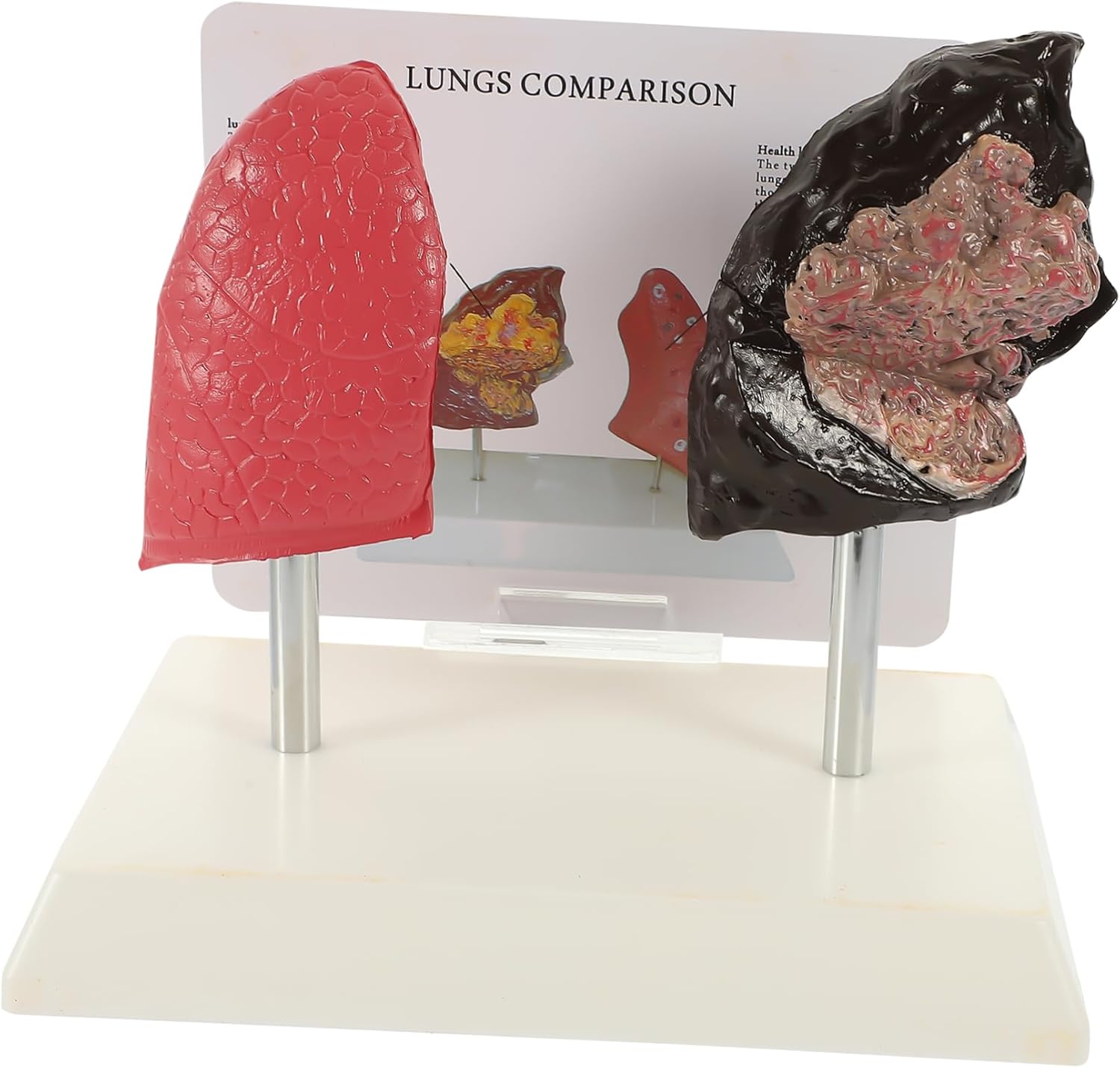 NAMOARLY Realistic Pvc Smoking Lung Model Educational Comparison Teaching Tool for Respiratory Anatomy Medicine School Anatomy