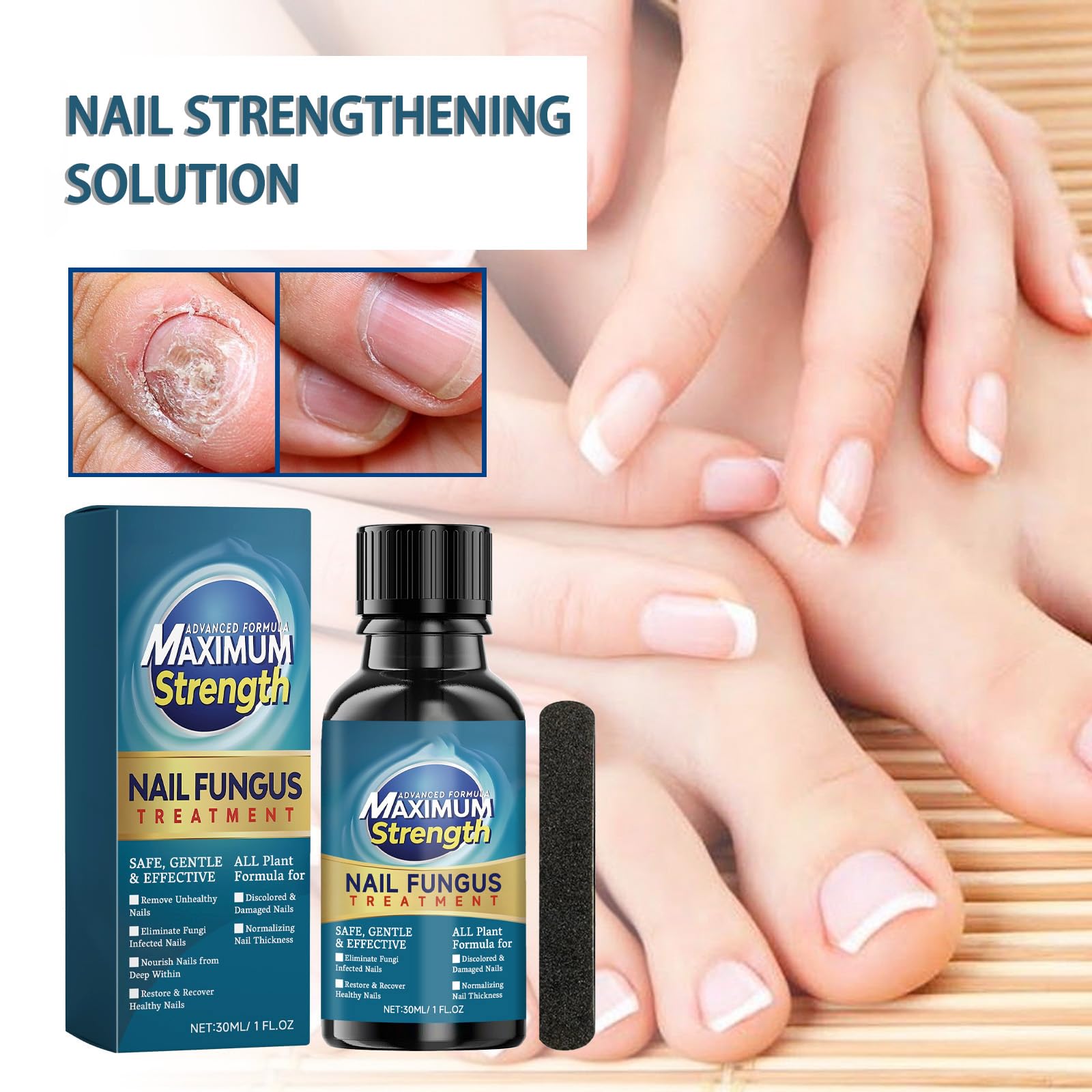 Extra Strong Nail Fungal Treatment for Toenail Anti Fungal Nail Extra Strong, Toe Nail Treatment ExtraStrong, Nails Repair - Image 2