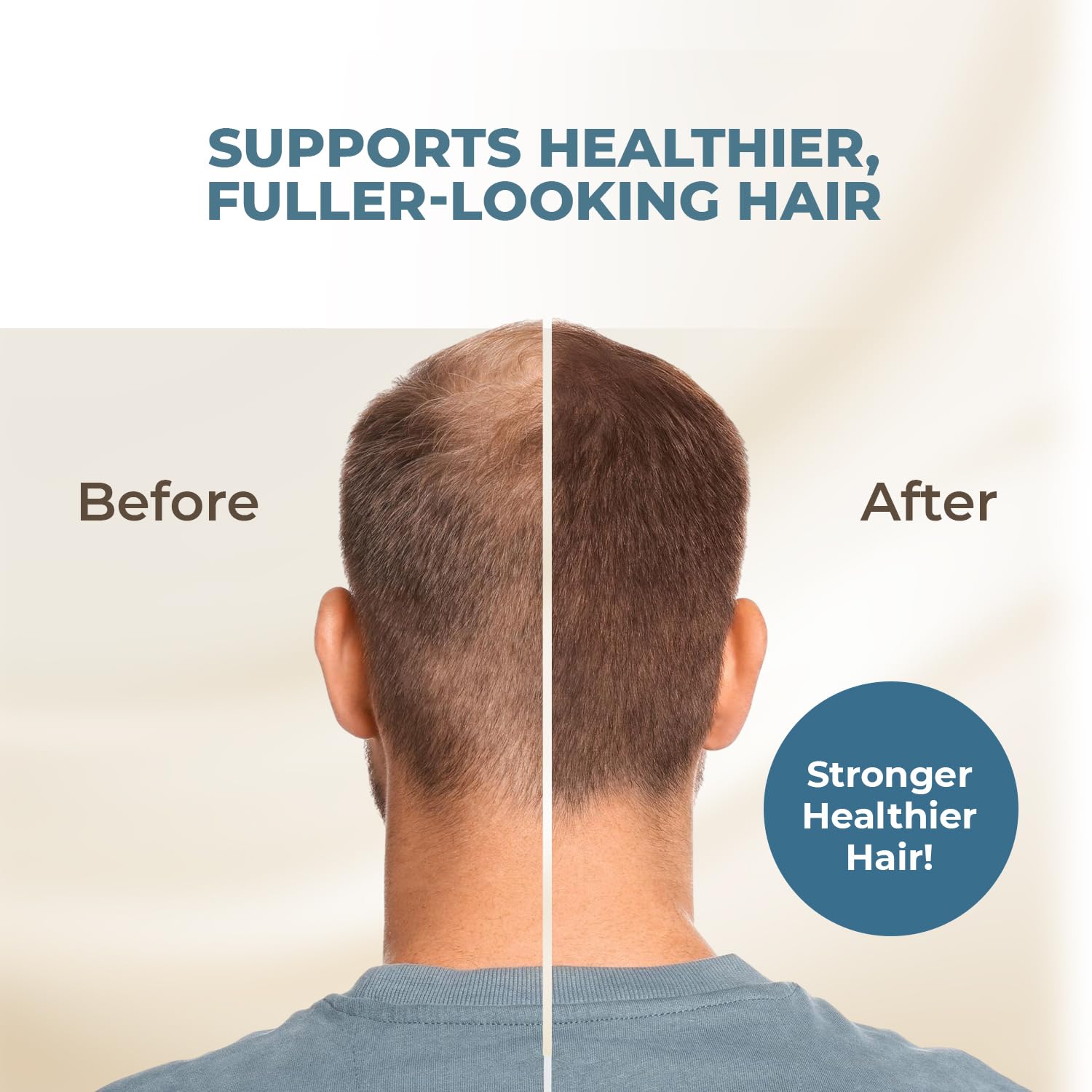 HAIRMETTO Hair Growth Oil with Saw Palmetto & Pumpkin Seed