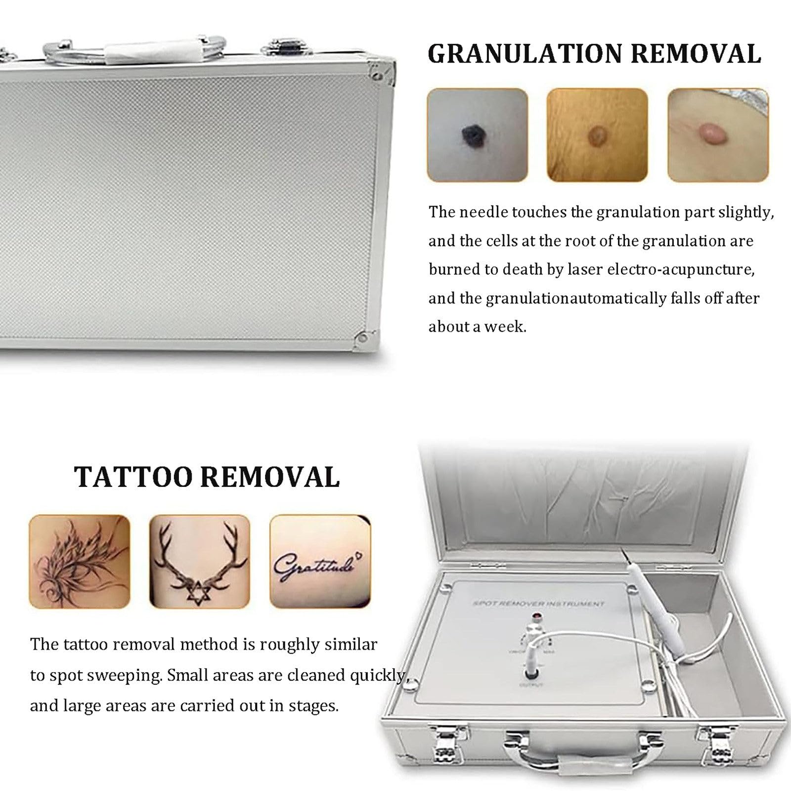 Lápiz De Plasma Láser De 10 Niveles, Lápiz Electrónico para Eliminar Lunares Y Tatuajes, Herramienta De Belleza para El Cuidado Facial, para Eliminar Manchas Oscuras, Pecas, Nevos Y Verrugas