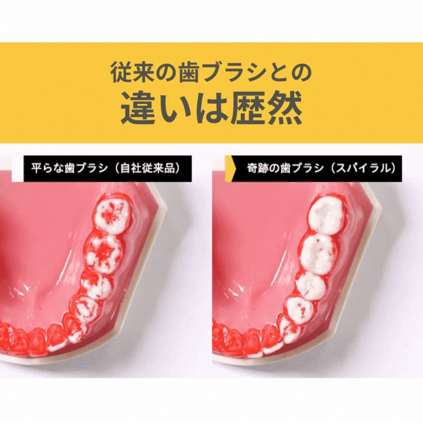 Amazon | 奇跡の歯ブラシ [スパイラル] クリアブラック 12本セット