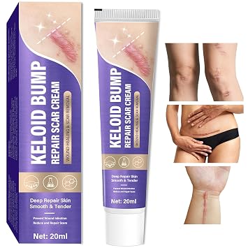 Keloid Bump Removal with Botanical Extracts, Soothing Keloid Bump Cream for Daily Care, Softening Keloid Scar Gel, Skin-Safe Keloid Support