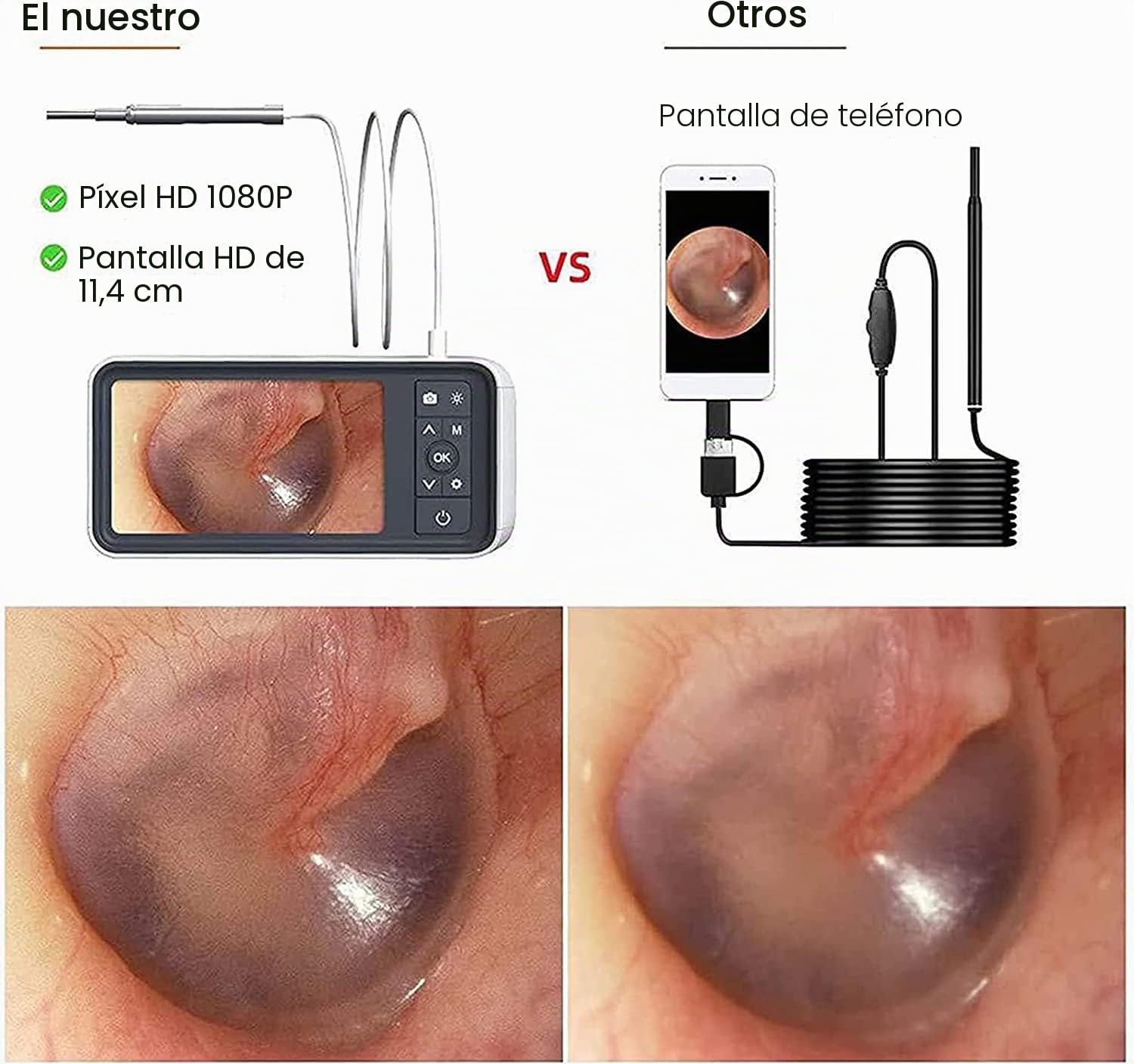 Otoscopio digital con pantalla HD y luces LED para inspección de oídos en adultos, niños y mascotas
