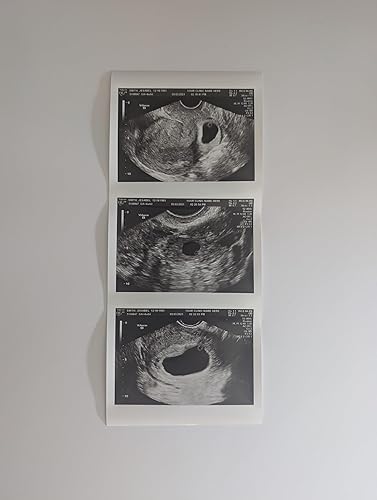 Miniatura 2 de Prank 2D Customized Fake Ultrasound Strip of 3 Photos