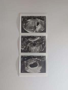 Prank 2D Customized Fake Ultrasound Strip of 3 Photos