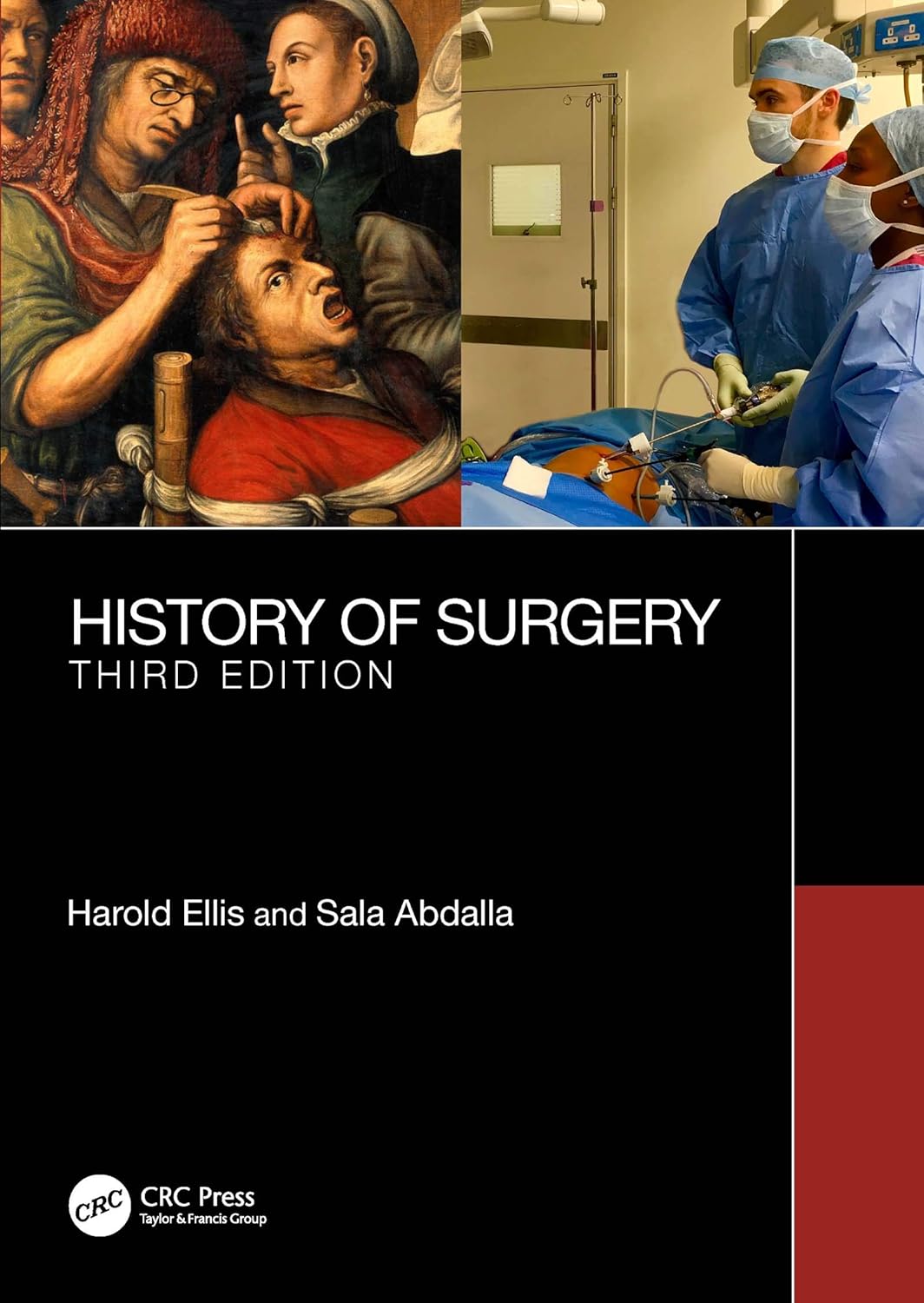 A History of Surgery: Third Edition      3rd Edition, Kindle Edition