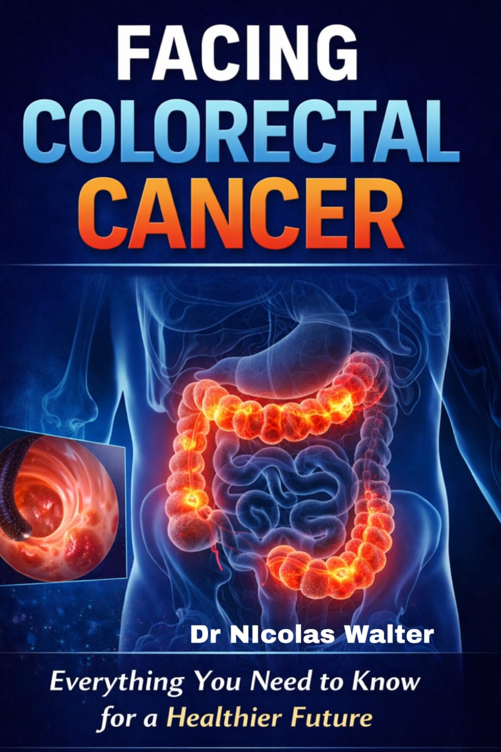 Facing Colorectal Cancer: Everything You Need to Know for a Healthier Future