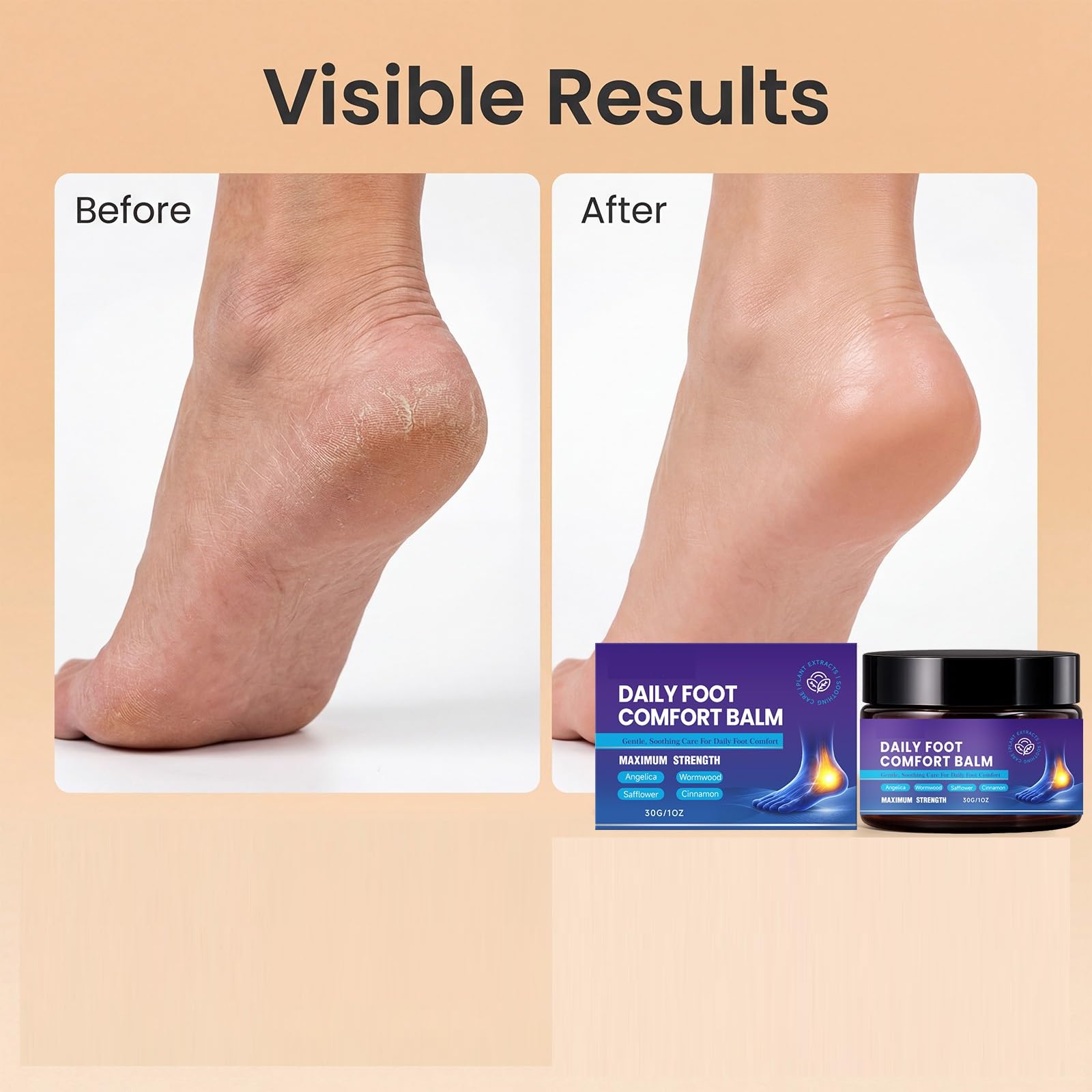 Foot Comfort Balm, Natural Foot Soothing Balm, crema idratante per i piedi, crema idratante per la cura dei piedi, per pelle secca screpolata, sollievo dalla pressione, 30 g (10 pezzi)