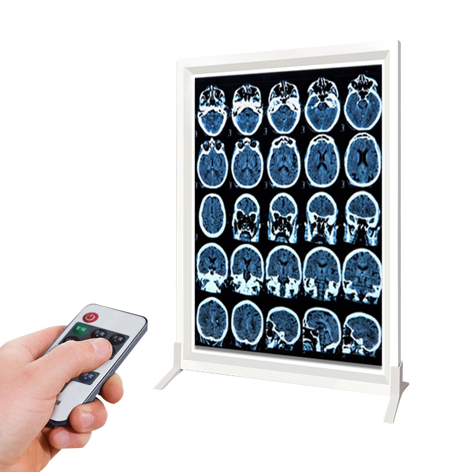 Boîte de visualisation à rayons X LED avec télécommande à intensité variable, éclairage sans scintillement pour hôpital X-Film ou équipement de laboratoire CT-Film