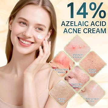 Azelaic Acid 14% Face Cream, Premium Acne Treatment with Salicylic Acid & Niacinamide, Calms Facial Redness, Controls Oil & Soothes Skin Irritation, 2 Oz