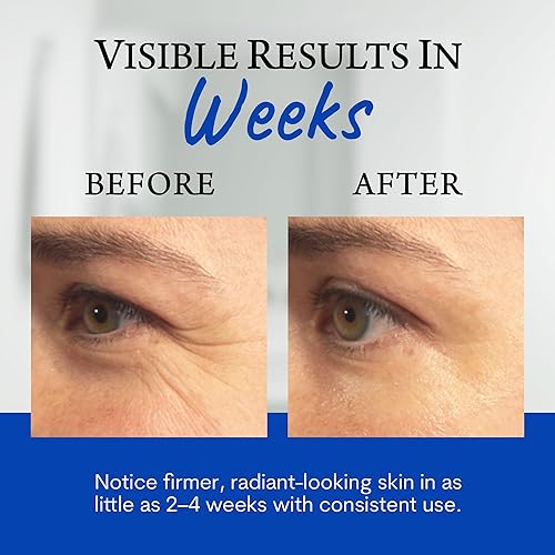 Miniatura 5 de Biologic Sta-Tight - Suero antienvejecimiento  Suero facial suavizante para mujeres para arrugas y líneas finas alrededor de los ojos, la boca y la