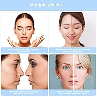 Vista 5 de Máquina de dermoabrasión de diamante 3 en 1, aspiradora profesional de poros para tonificar la piel, limpiador de eliminación de cabeza negra