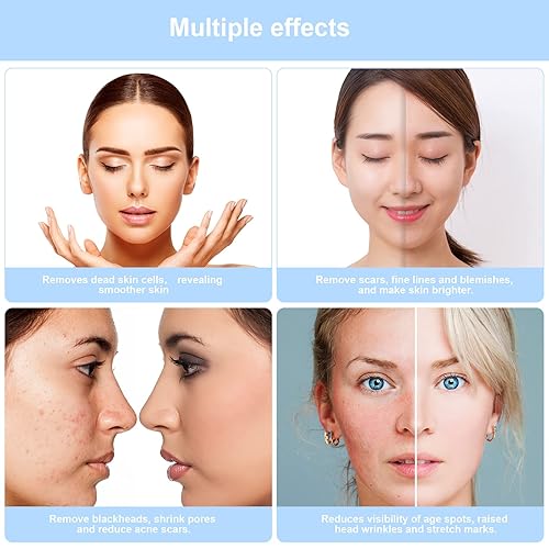 Miniatura 6 de Máquina de dermoabrasión de diamante 3 en 1, aspiradora profesional de poros para tonificar la piel, limpiador de eliminación de cabeza negra con