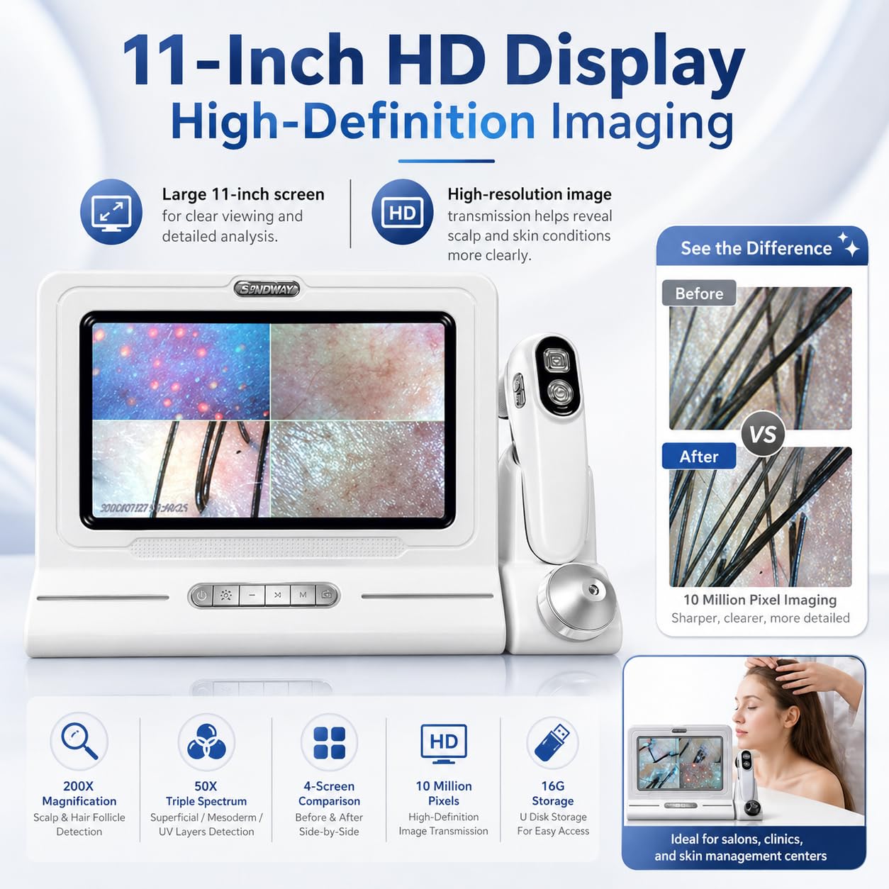 Analizador de diagnóstico de piel, 11 pulgadas, 50 x 200 x, tipo de carga digital, microscopio de cuero cabelludo, folículo piloso, detector de pelo de piel, máquina para el hogar, salón de belleza
