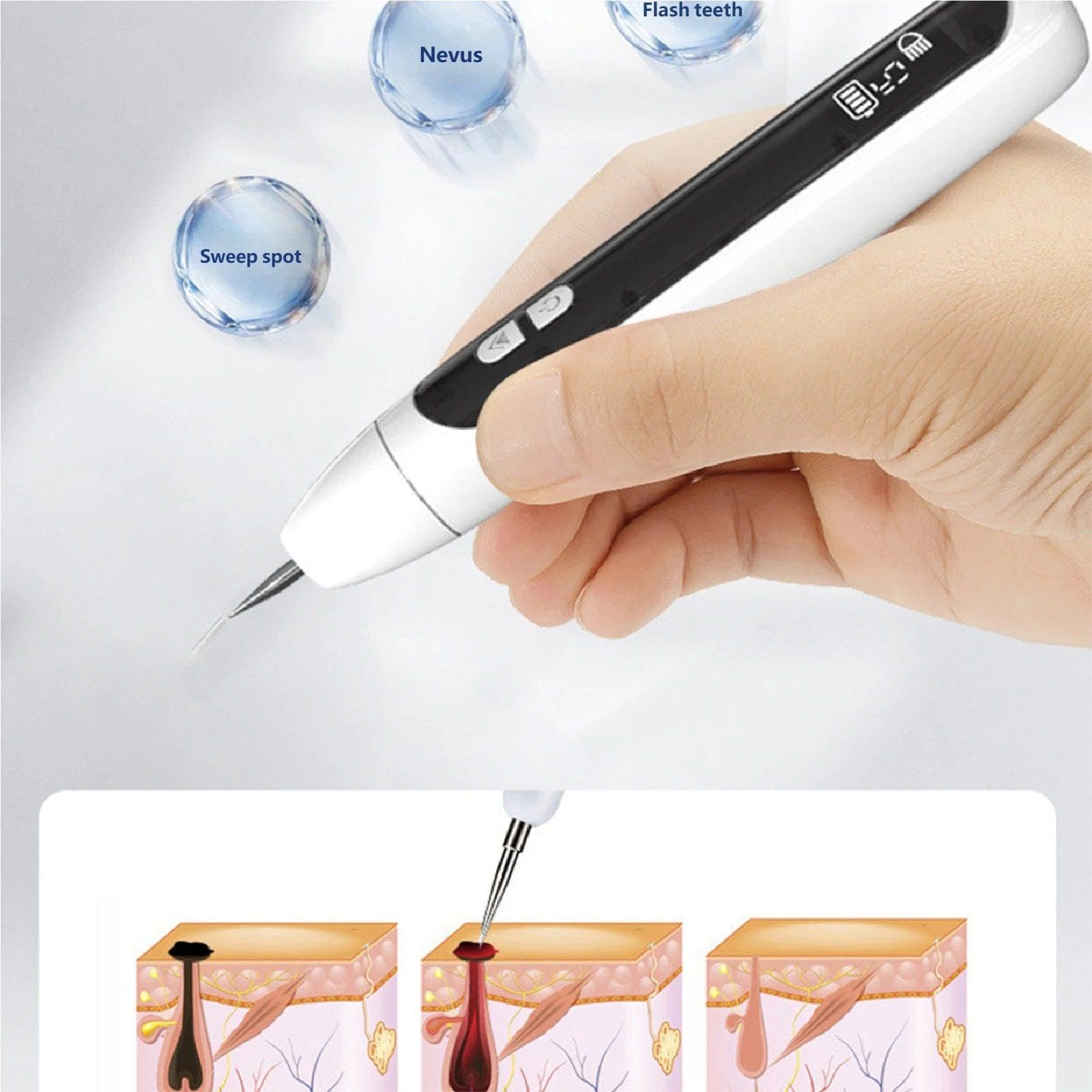 Muttermal Entferner 12 Warzen Und Dornwarzen Stift Tattoo Entfernungsstift Plasma-Pen zur Entfernung von Sommersprossen, Muttermalen und Warzen für die Anwendung zu Hause
