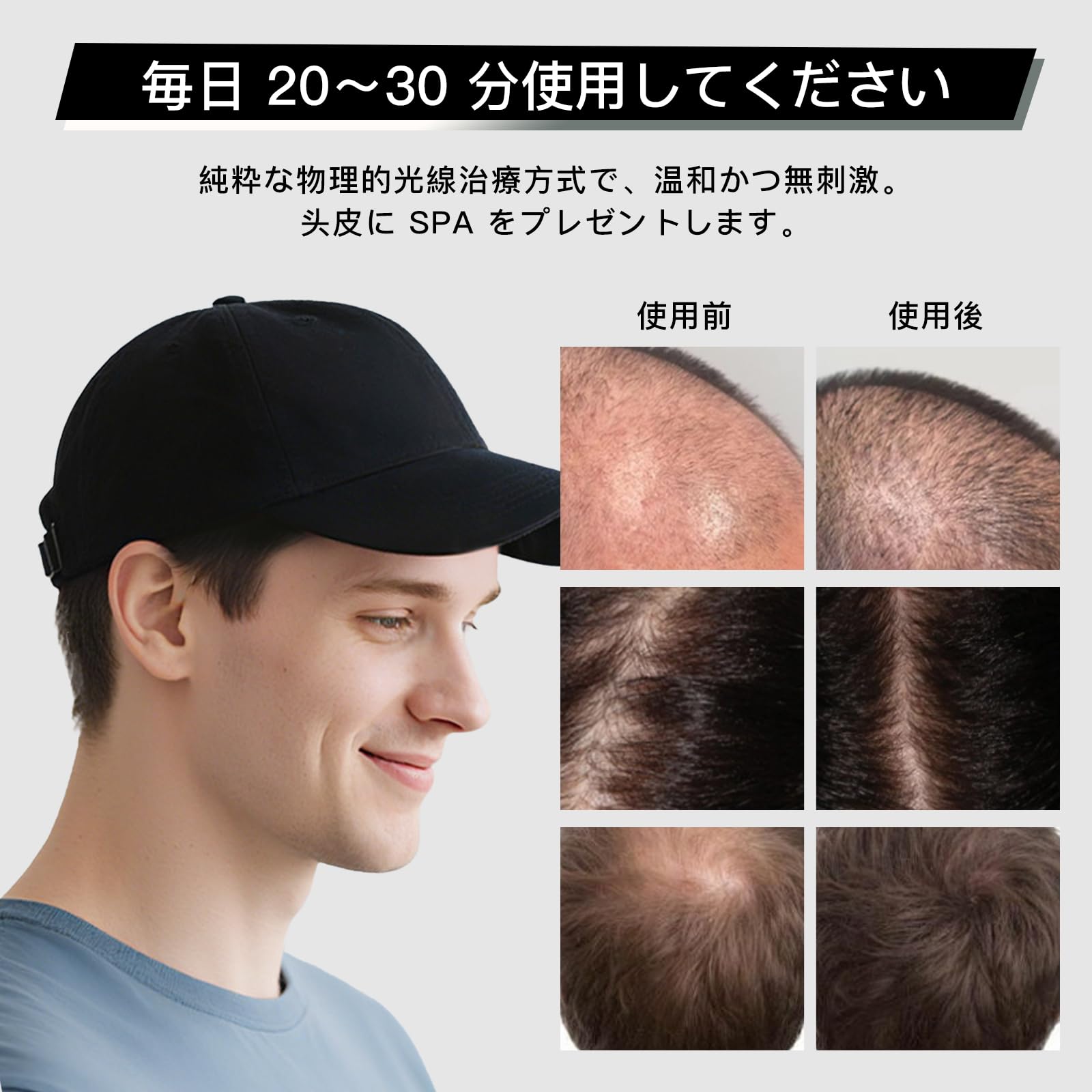 Amazon.co.jp: LED育毛キャップ 赤色LED 青色LED 頭皮 赤色光キャップ