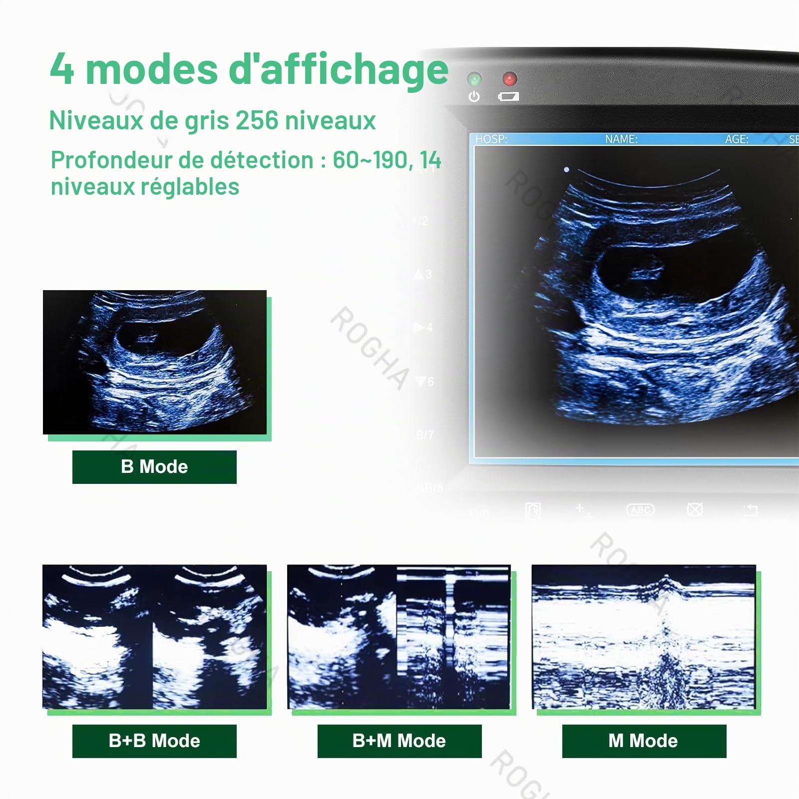 ÉChographe B Portable pour Animaux Echographie Appareil Grossesse Machine à Ultrasons Vétérinaire avec Sonde 3.5 MHz,écran 5.6 Pouces,pour Porcs Et Moutons