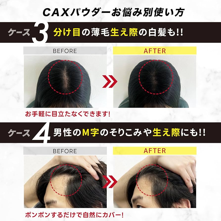 C.A.X ブラック ヘアボリュームパウダー&スプレーセット C.A.X ブラック ヘアボリュームパウダー&スプレーセット Amazon