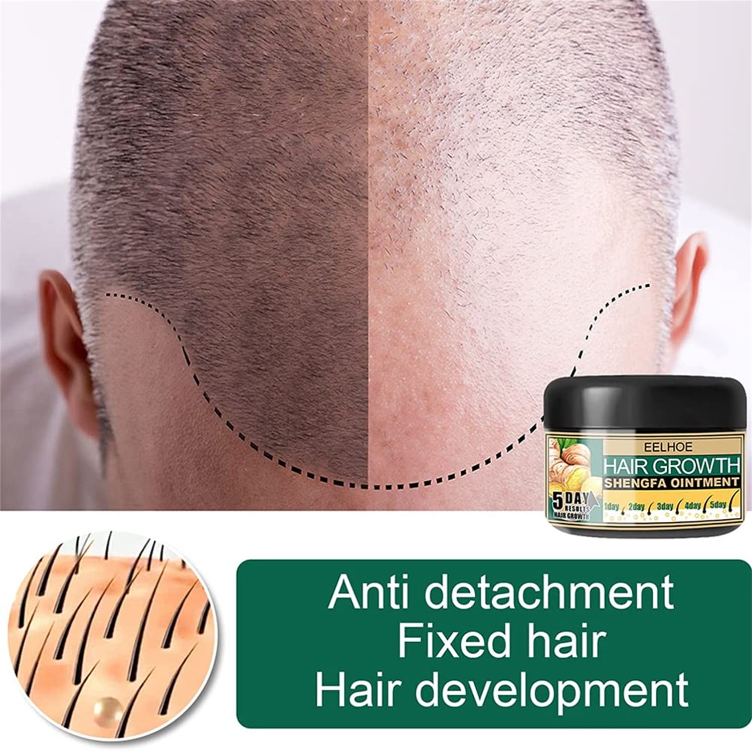 Amazon｜ヘアブーストジンジャークリーム、ジンジャーヘアグロース軟膏