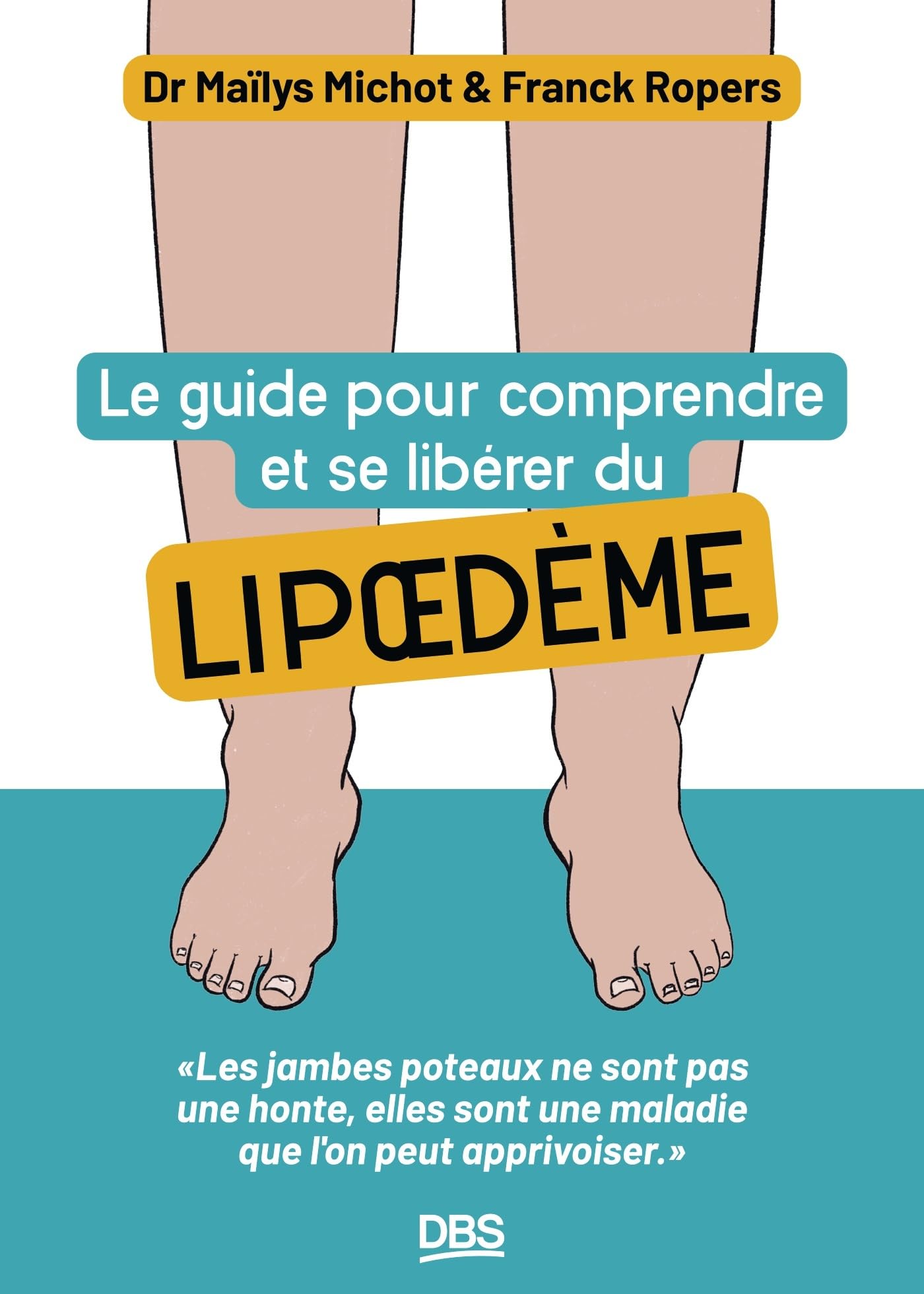 Le guide pour comprendre et se libérer du lipoedème: Les jambes poteaux ne sont pas une honte, elles sont une maladie que l'on peut apprivoiser