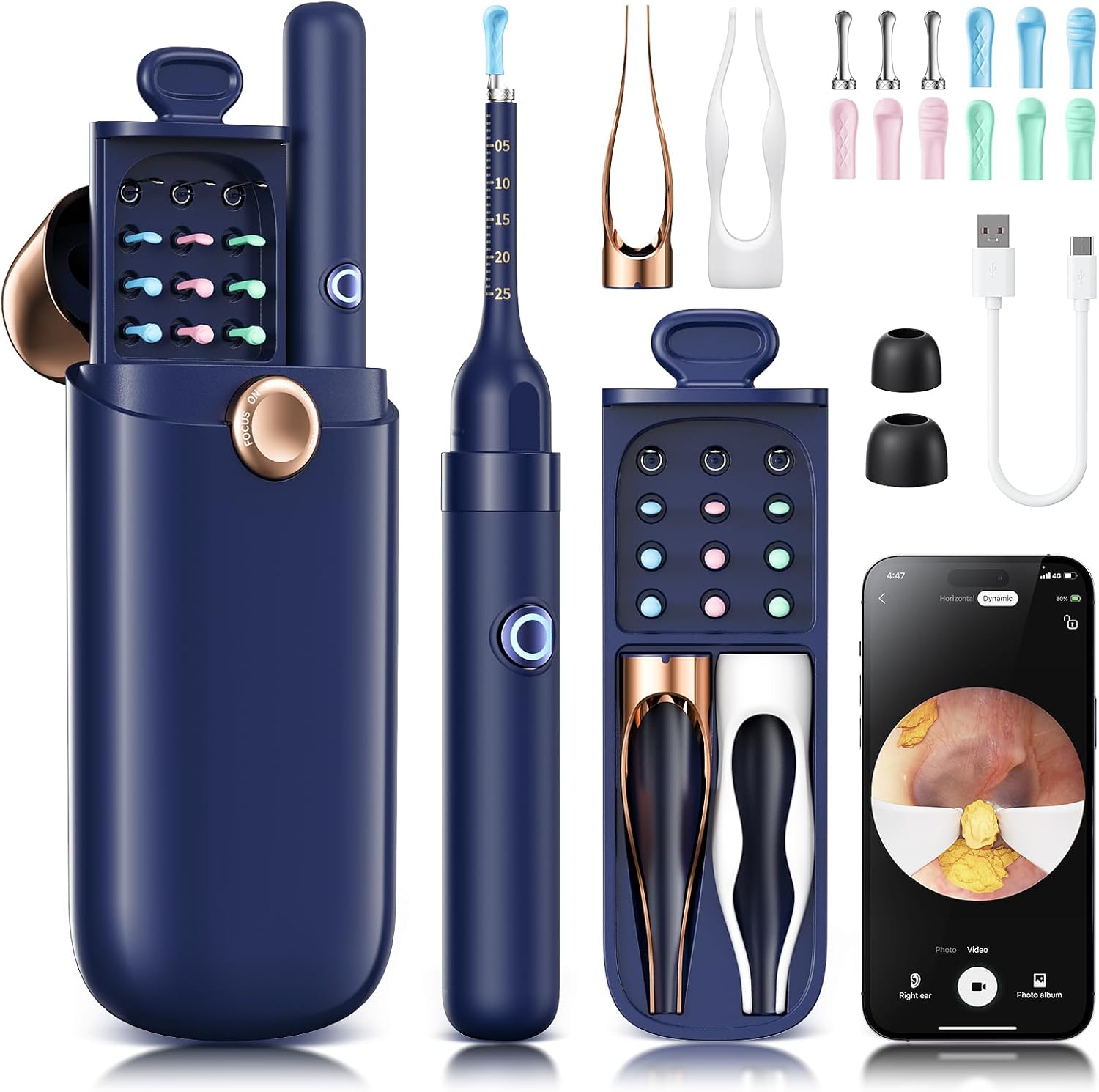 Loyker Ear Wax Removal, Ear Cleaner with 1080P Camera, Ear Cleaning Kit with 12 Ear Pick, Visual Ear Picker Earwax Remover Tweezers with 6LED Light, Ear Camera for iPhone, iPad, Android Phones, Blue