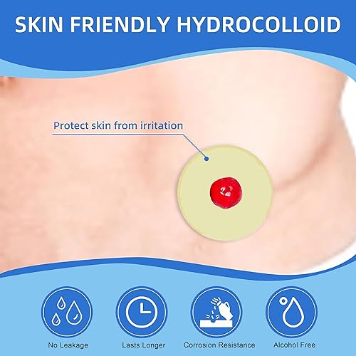 Miniatura 2 de 20 anillos de barrera de ostomía de 0.079 pulgadas, suministros moldeables para ostomía, suministros flexibles de bolsa de ostomía hidrocoloide de