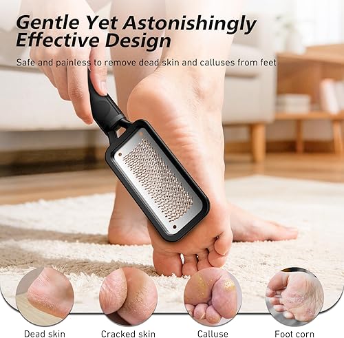 Miniatura 3 de BALUCA Lima profesional y removedor de callos  Escofina de pies de acero inoxidable y pies de metal, herramienta de pedicura para piel dura y