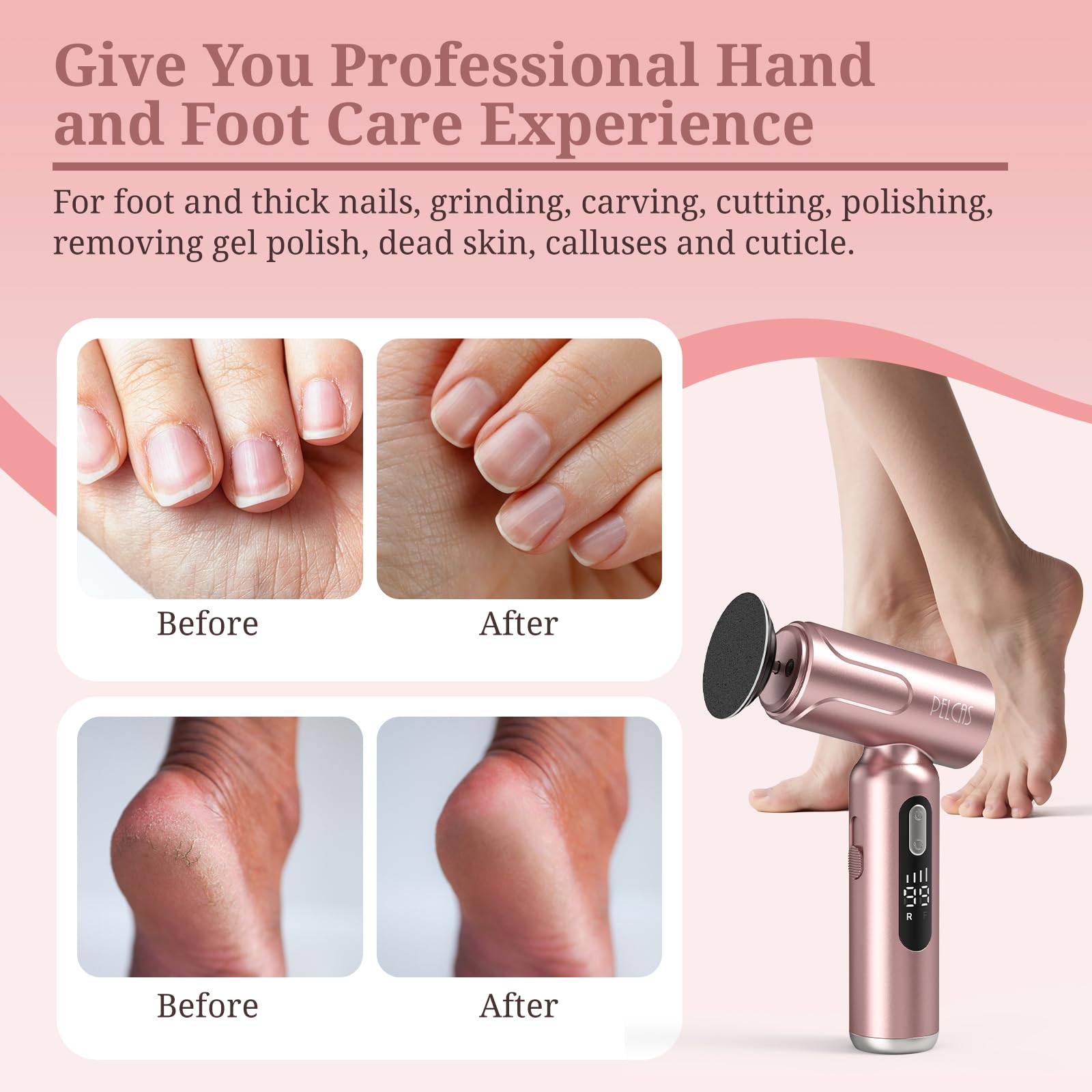 PELCAS Electric Foot Callus Remover 2-in-1 Pedicure and Nail Care Kit