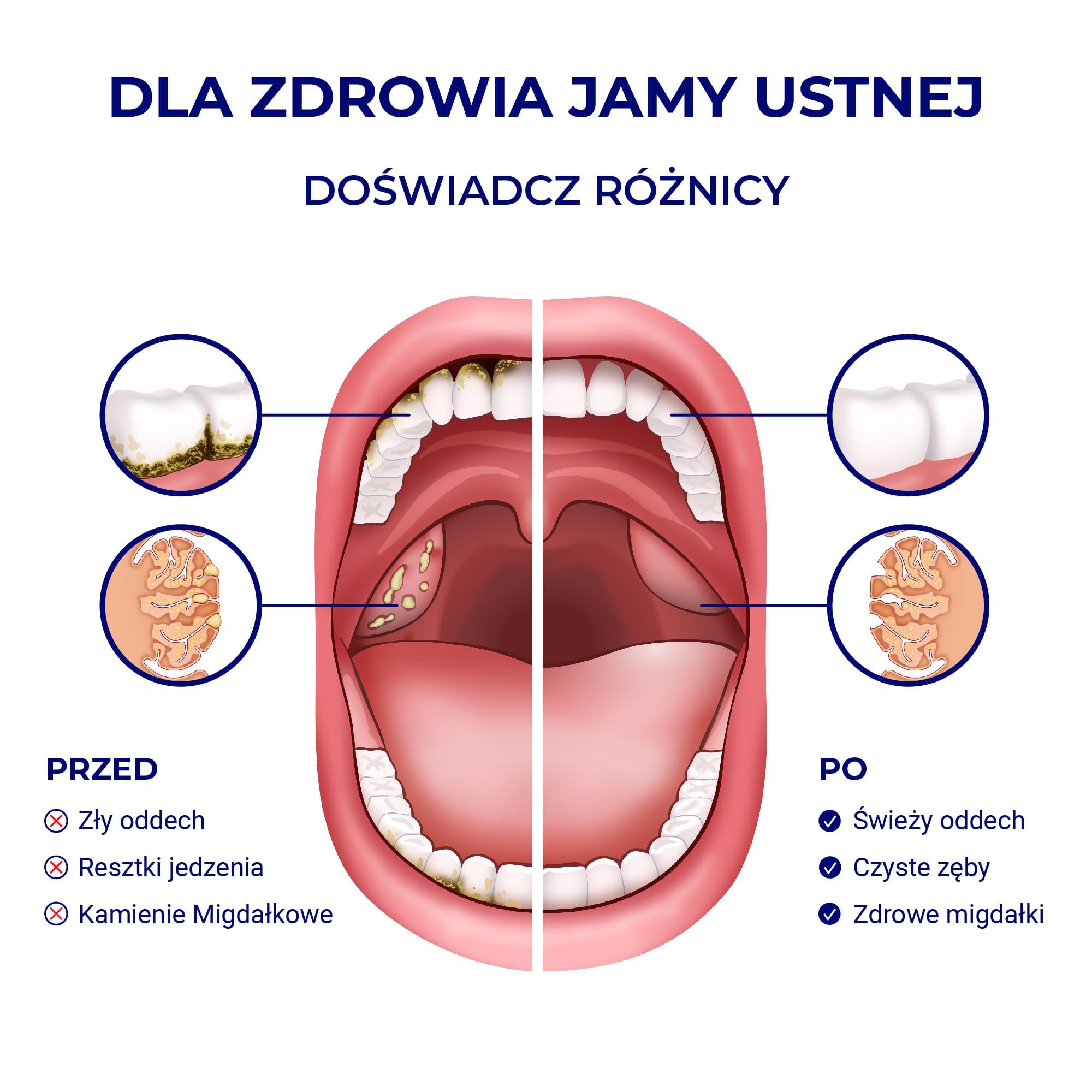 Oravix Irygator do Jamy Ustnej, Usuwanie Kamieni Migdałkowych, Bezprzewodowy, do Usuwania Kamieni Migdałków, Irygator Jamy Ustnej