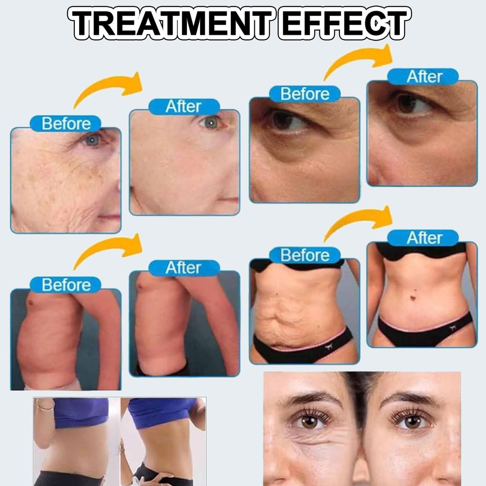 Máquina De Reafirmación Facial 7d Hifu, Dispositivo Profesional De Lifting Facial Y Corporal para Reducción De Arrugas, Reafirmación Y Antiedad con 7 Sondas