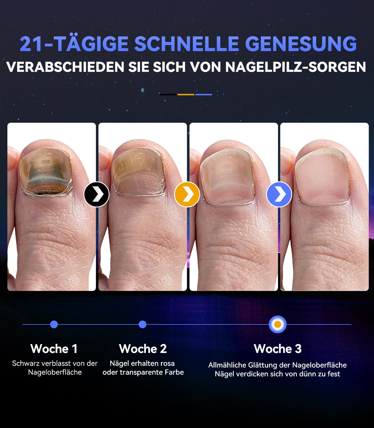 2025 Upgrade Nagelpil Lasergerä【Intelligente Zeitsteuerung 3/5/7/10min】mit Zeitanzeige Zusammenklappbar - Für unterwegs/im Freien, zum Mitnehmen Laser(blau)