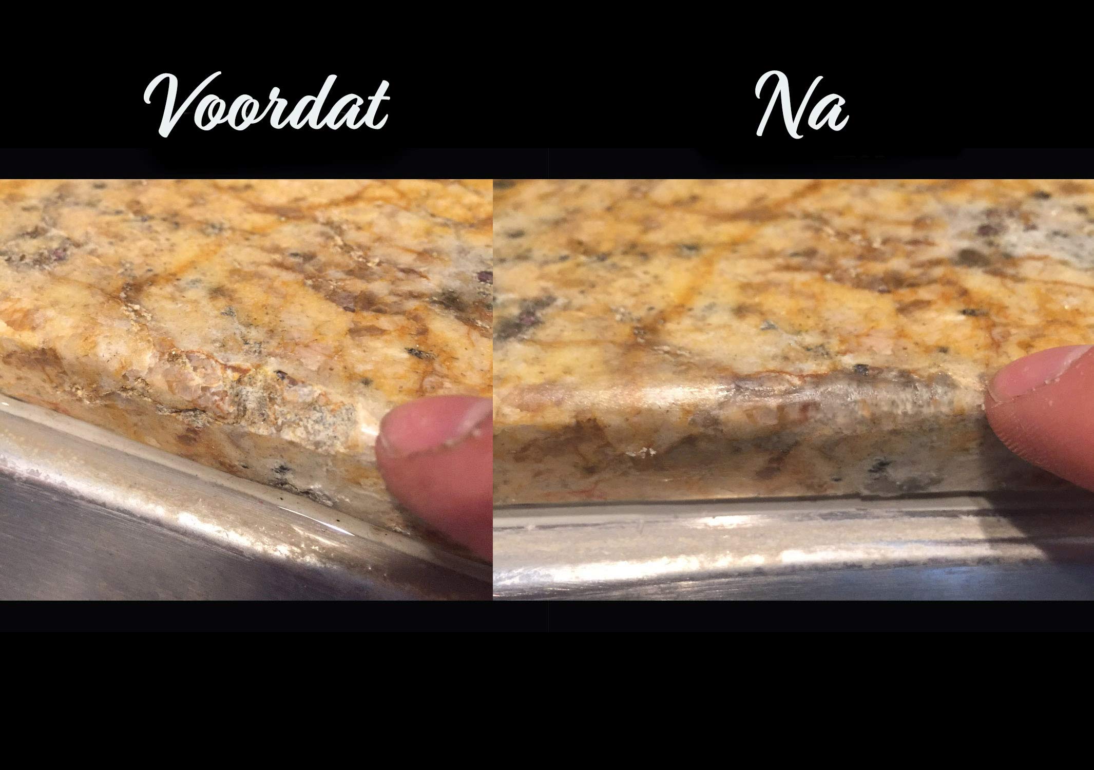 HIMG Lca(Tm) Clear, Light Cure Acrylic Diy Surface Repair Kit For