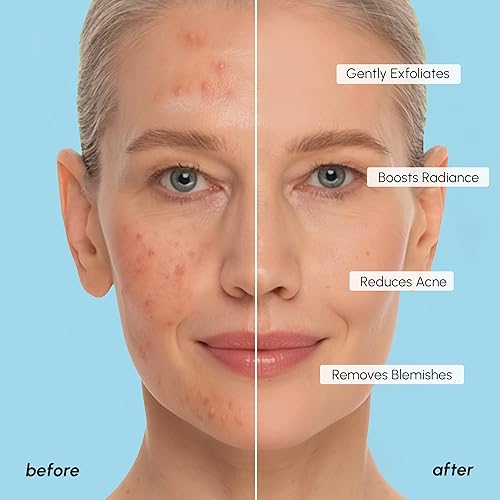 Vista 20 de MAREE Almohadillas de ácido glicólico – Almohadillas de tóner para limpieza facial – Almohadilla exfoliante con aceite de árbol de té, ácido