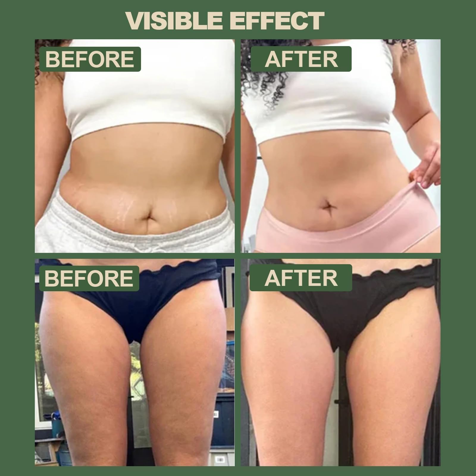 Máquina Celulitis Ventosa, Masajeador Anticelulítico Reductor Eléctrico, 12 Niveles de Calor, 12 Niveles de Succión, Reafirma la Piel, Reduce la Celulitis