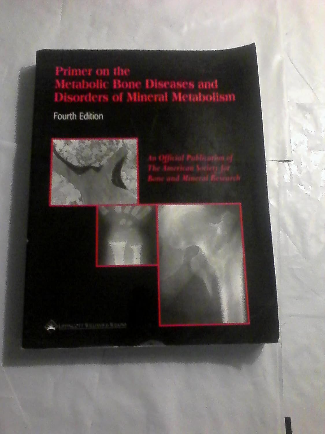 Primer on the Metabolic Bone Diseases and Disorders of Mineral ...