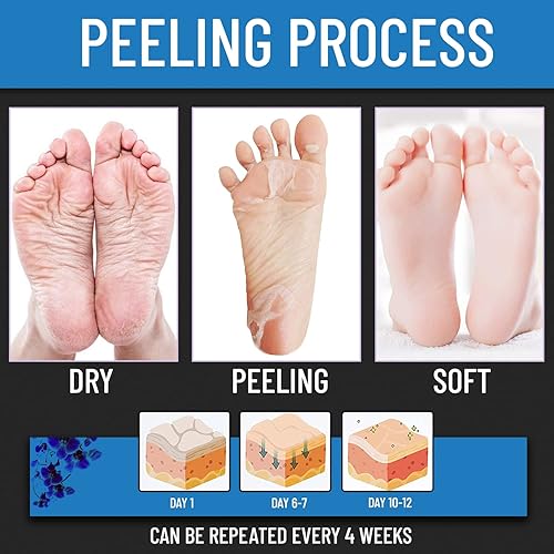 Miniatura 3 de VALITIC Mascarilla exfoliante para pies secos agrietados y eliminación de callos de piel muerta - Vitamina E y Aloe Vera colágeno hidratante