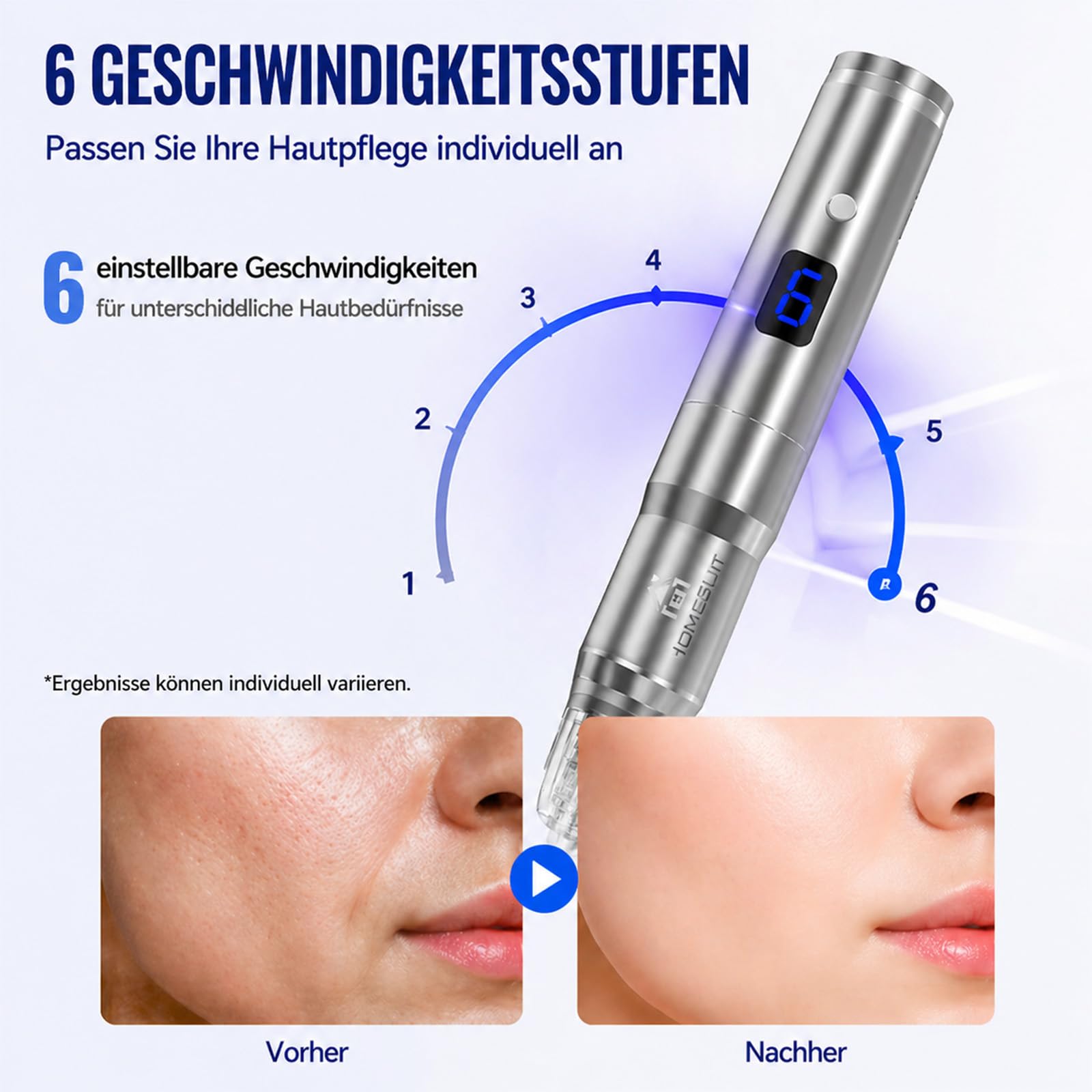 Microneedling Pen 023 Silber - Einstellbare Nadellänge 0–2,5mm, 6-stufige Vibrations- & Heizfunktion, USBC Aufladbar, Tragbares Hautpflegegerät für Zuhause und Reisen,mit Nadeln,Cartridges,LCD Display