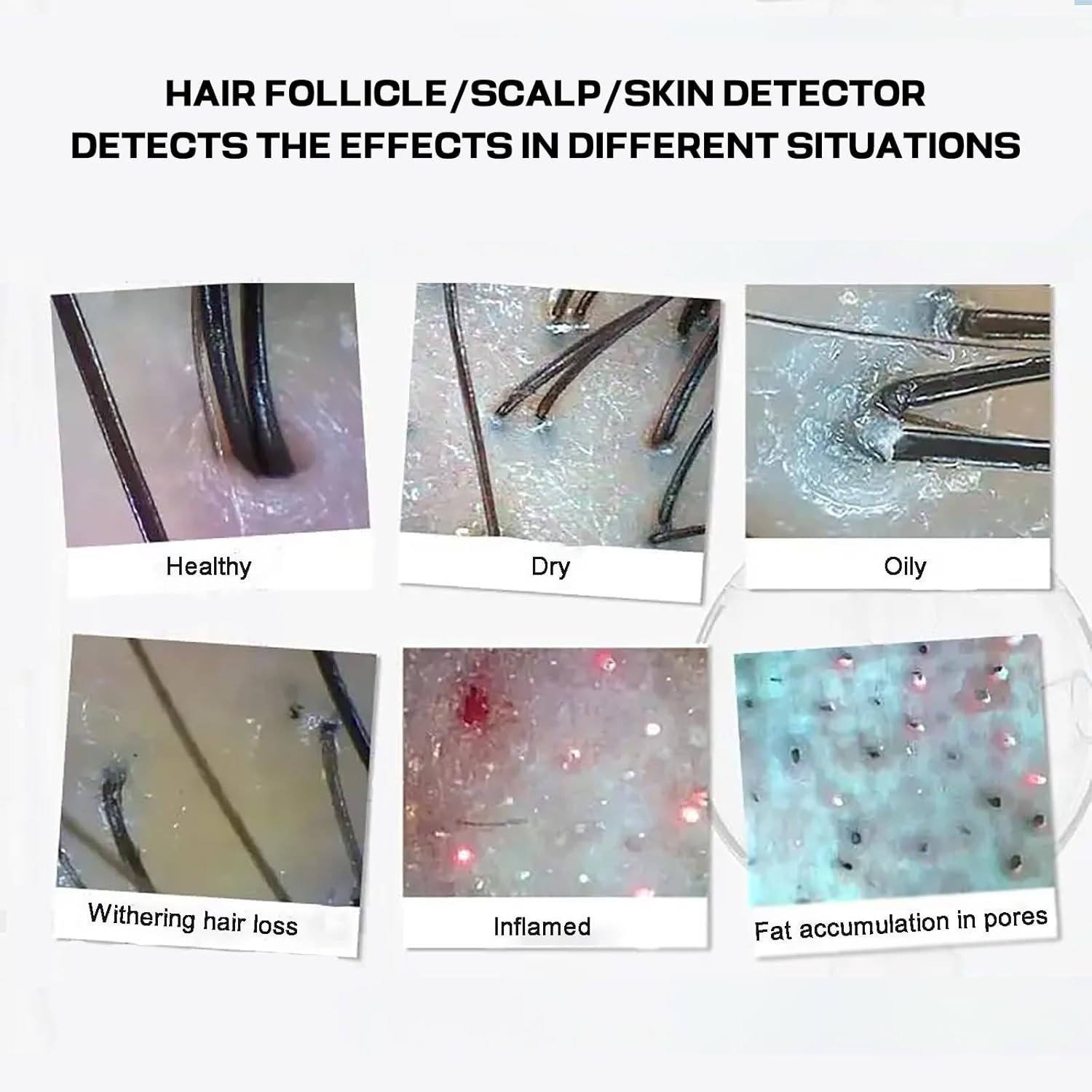 Skin Diagnosis Hair Analyzer Machine, 50X/200X Skin Hair Scalp Detector Analyzer Scalp Hair Follicle Skin Analysis Machine with 11 Inch LCD Screen