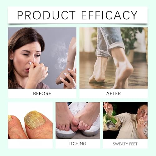 Miniatura 3 de Aerosol desinfectante de pies con aceite de árbol de té, spray desinfectante transparente para pies, aceite de árbol de té, frescura de pies y