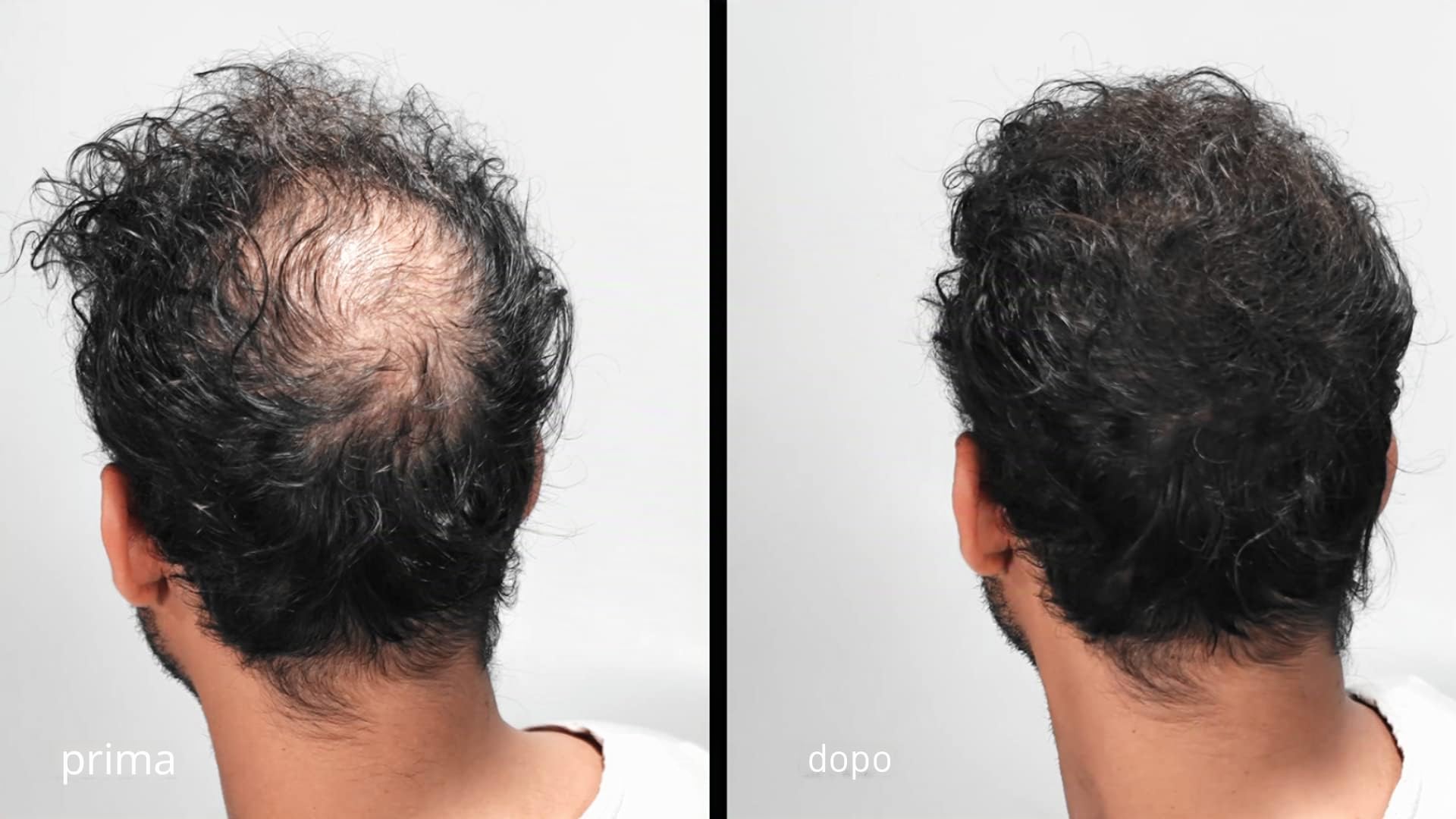 LUXE Fibre ispessimento capelli con cheratina naturale - Dura 2 mesi! - Testato da dermatologi – Ipoallergenico - Molteplici colori disponibili. Castano scuro