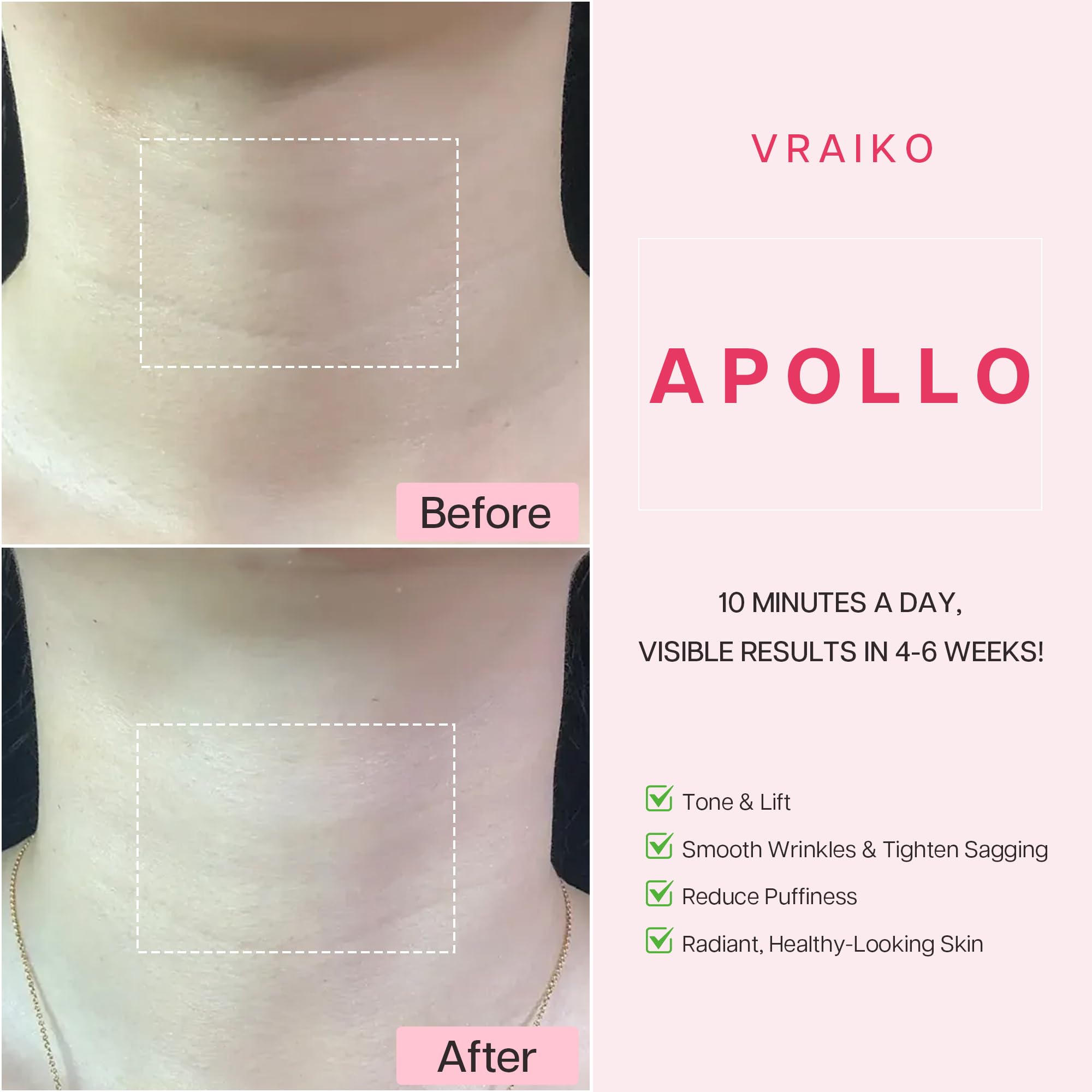 VRAIKO APOLLO masażer do liftingu szyi, EMS Gua Sha, podwójne działanie LED, wodoodporny IP65