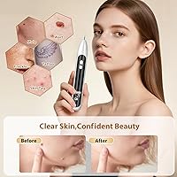 Vista 4 de Nodhaul Effective Maximum Strength WART Remover,Mole and Wart Removal Pen,Dark Spot Removal for Face and Body